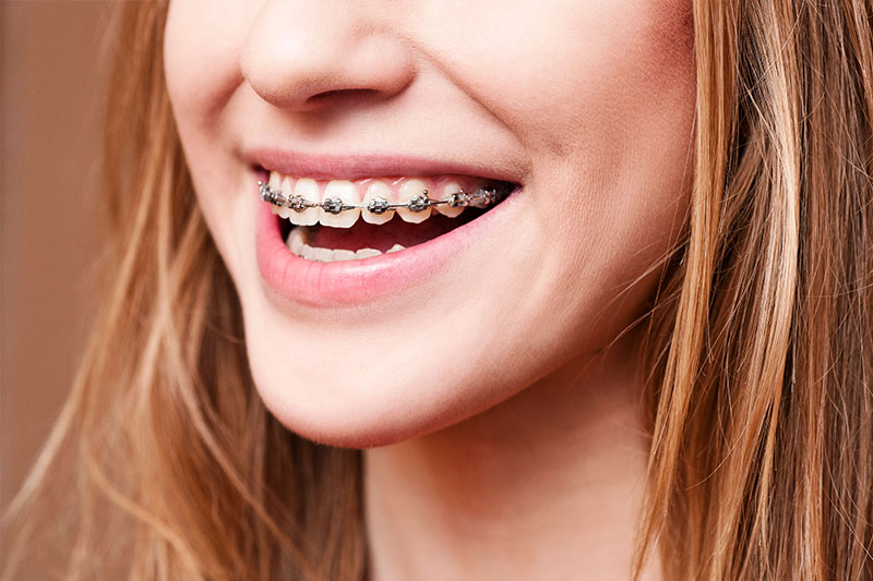 Orthodontics in National City